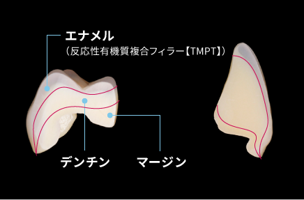エナメル デンチン マージン
