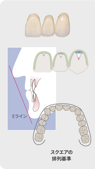 スクエアの排列基準