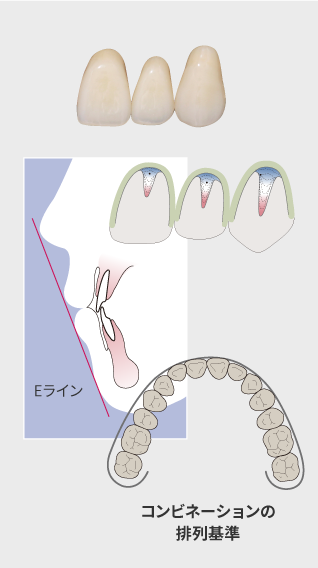 コンビネーションの排列基準