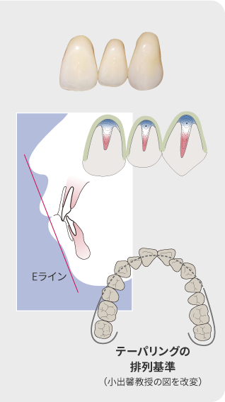 テーパリングの排列基準